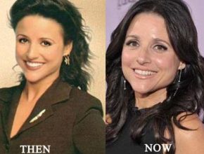 Julia Louis-Dreyfus before and after plastic surgery (17)