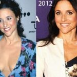 Julia Louis-Dreyfus before and after plastic surgery (19)