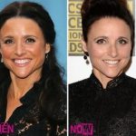 Julia Louis-Dreyfus before and after plastic surgery (20)