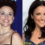 Julia Louis-Dreyfus before and after plastic surgery (21)