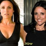 Julia Louis-Dreyfus before and after plastic surgery (22)