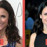 Julia Louis-Dreyfus before and after plastic surgery (24)