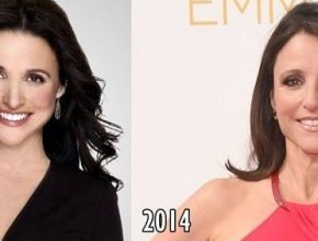 Julia Louis-Dreyfus before and after plastic surgery