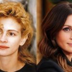 Julia Roberts before and after plastic surgery (13)