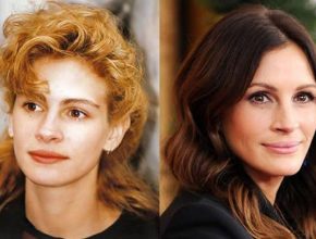 Julia Roberts before and after plastic surgery (13)