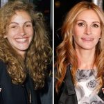 Julia Roberts before and after plastic surgery (3)