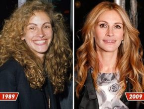Julia Roberts before and after plastic surgery (3)