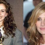 Julia Roberts before and after plastic surgery (37)