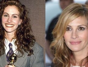 Julia Roberts before and after plastic surgery (37)