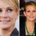 Julia Roberts eye lid plastic surgery (32)