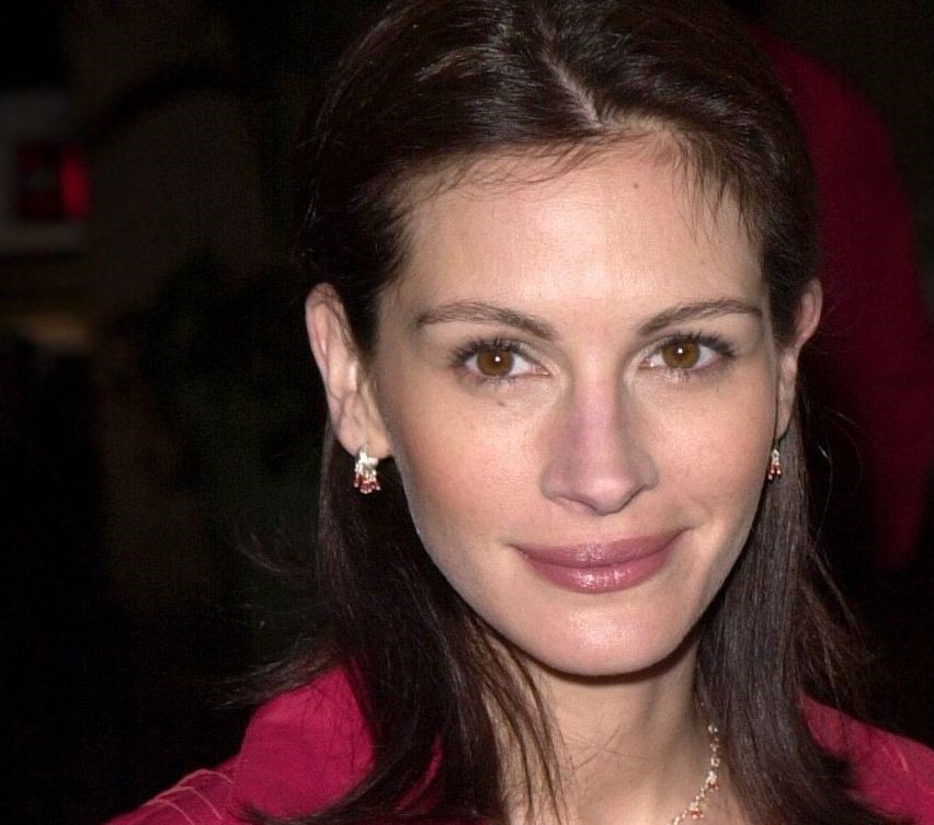 Julia Roberts plastic surgery (21)