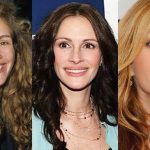 Julia Roberts plastic surgery (34)