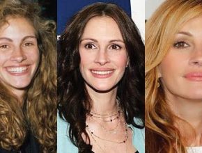 Julia Roberts plastic surgery (34)