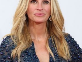 Julia Roberts plastic surgery (40)