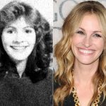 Julia Roberts plastic surgery then and now (15)