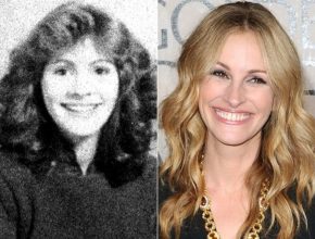 Julia Roberts plastic surgery then and now (15)