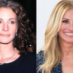 Julia Roberts plastic surgery then and now (2)