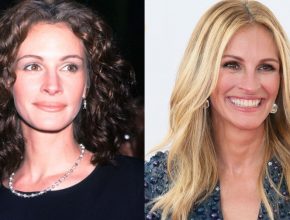 Julia Roberts plastic surgery then and now (2)