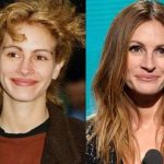 Julia Roberts plastic surgery then and now (33)