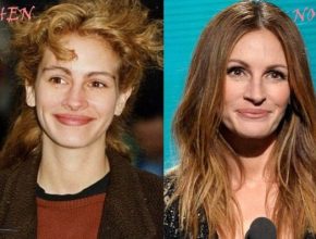 Julia Roberts plastic surgery then and now (33)