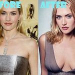 Kate Winslet after breast augmentation (28)