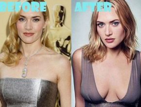 Kate Winslet after breast augmentation (28)