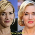 Kate Winslet before and after nose job (26)