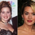 Kate Winslet before and after plastic surgery (24)