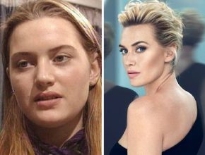 Kate Winslet before and after plastic surgery (30)