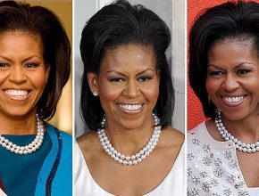 Michelle Obama before and after plastic surgery (21)