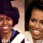 Michelle Obama before and after plastic surgery (23)