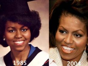Michelle Obama before and after plastic surgery (23)