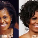 Michelle Obama before and after plastic surgery (24)