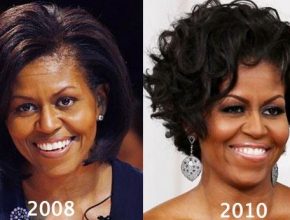 Michelle Obama before and after plastic surgery (24)