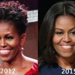 Michelle Obama before and after plastic surgery (25)