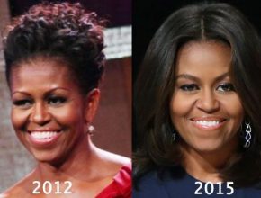 Michelle Obama before and after plastic surgery (25)