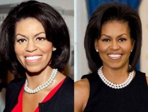 Michelle Obama before and after plastic surgery (26)