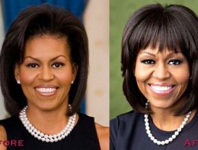 Michelle Obama before and after plastic surgery (27)