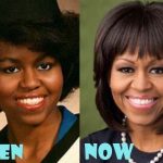 Michelle Obama before and after plastic surgery (28)