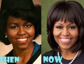 Michelle Obama before and after plastic surgery (28)