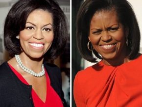 Michelle Obama before and after plastic surgery