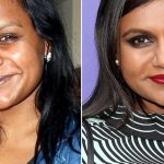 Mindy Kaling before and after plastic surgery