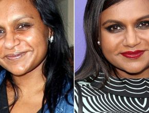 Mindy Kaling before and after plastic surgery