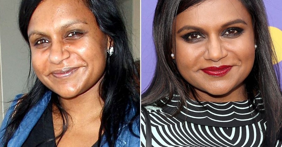 Mindy Kaling before and after plastic surgery