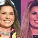 Shania Twain before and after plastic surgery (1)