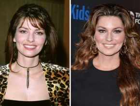Shania Twain before and after plastic surgery