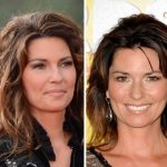 Shania Twain before and after plastic surgery (27)