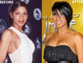 Toni Braxton before and after plastic surgery (29)