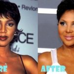 Toni Braxton before and after plastic surgery (30)