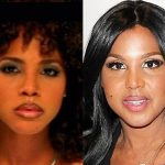 Toni Braxton before and after plastic surgery (31)